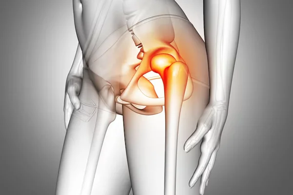 Robotic Hip Replacement